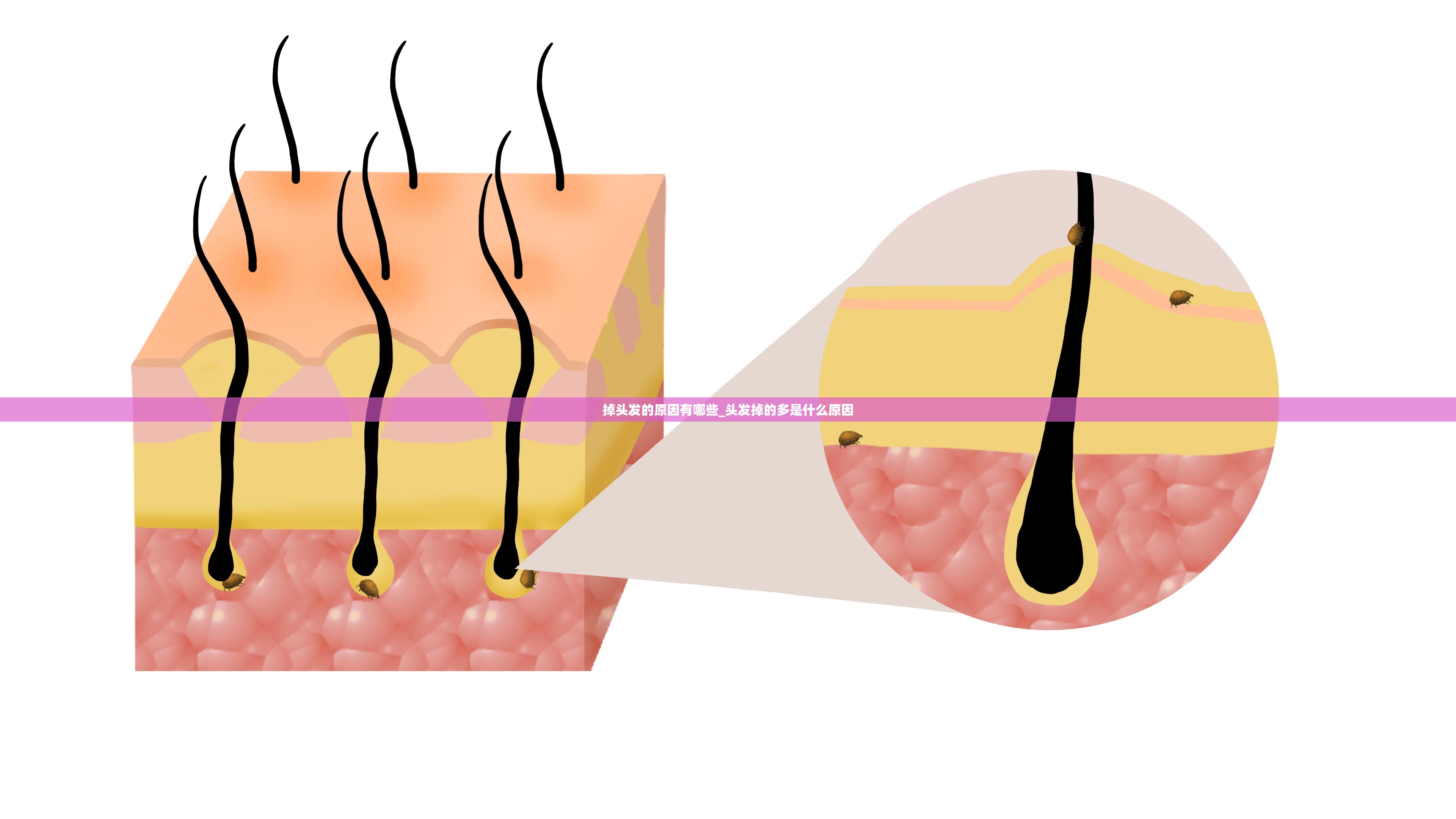 掉头发的原因有哪些_头发掉的多是什么原因