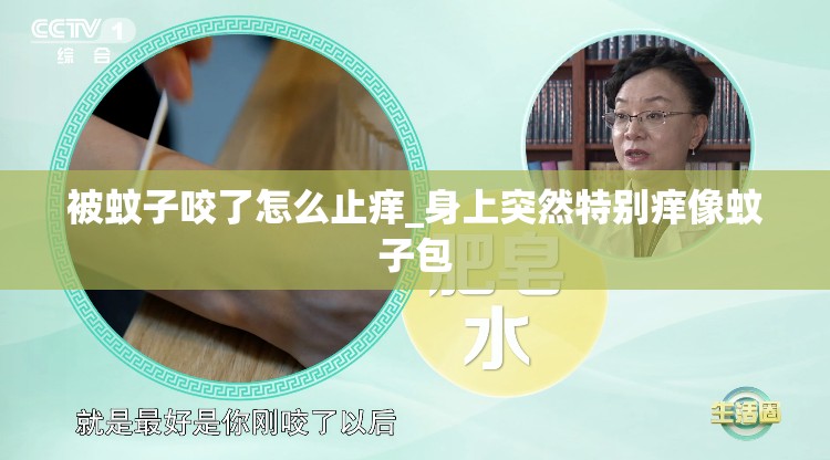 被蚊子咬了怎么止痒_身上突然特别痒像蚊子包