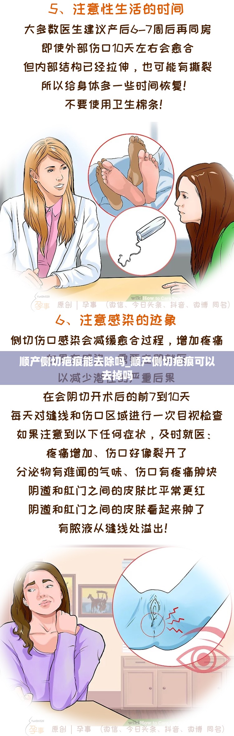 顺产侧切疤痕能去除吗_顺产侧切疤痕可以去掉吗