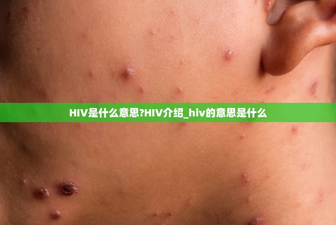 HIV是什么意思?HIV介绍_hiv的意思是什么